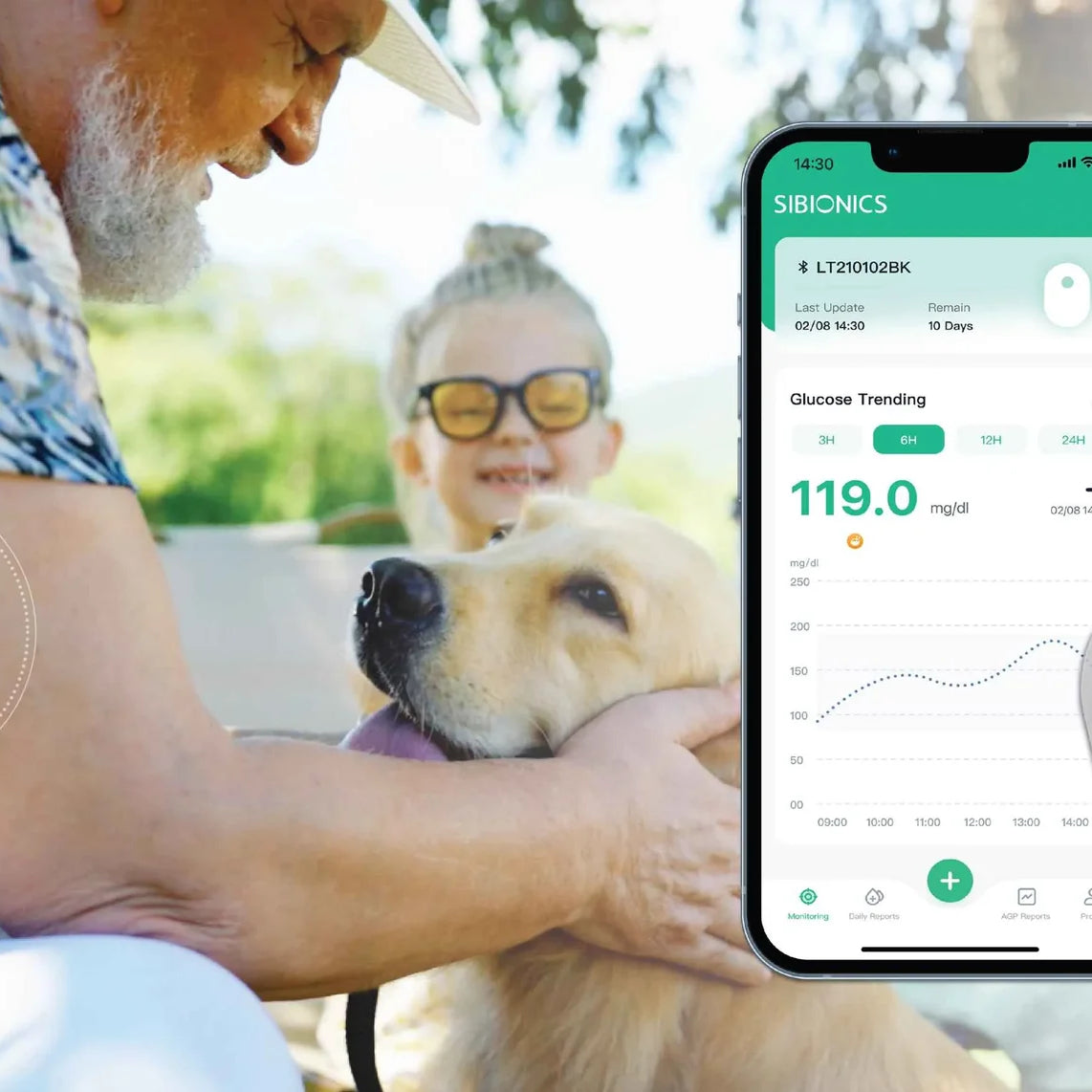 SIBIONICS GS1 – Kontinuirani merač glukoze