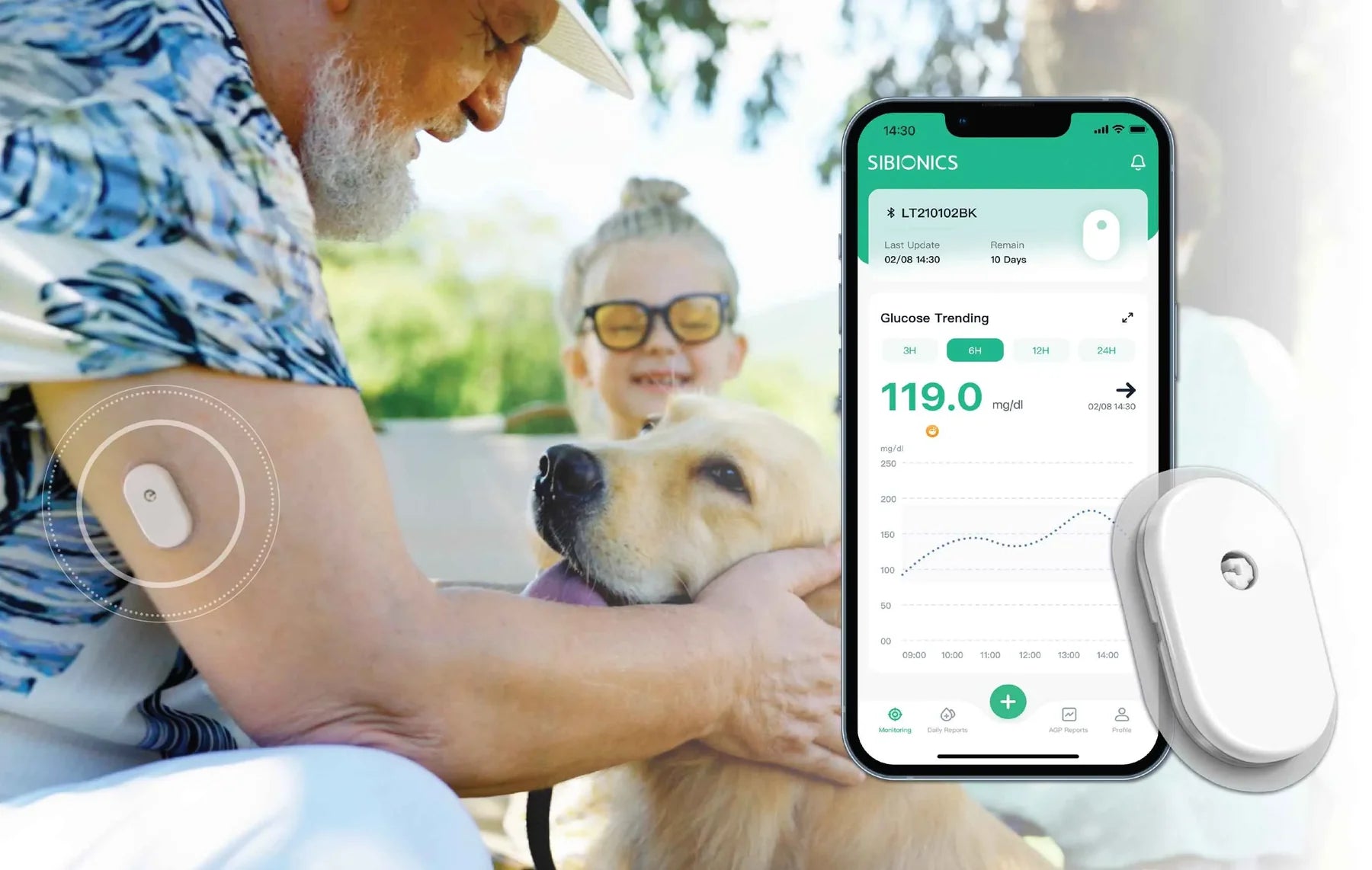 SIBIONICS GS1 – Kontinuirani merač glukoze