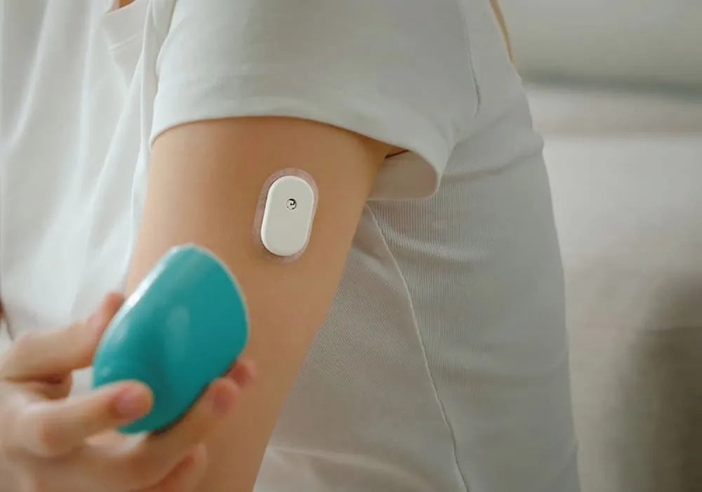 SIBIONICS GS1 – Kontinuirani merač glukoze