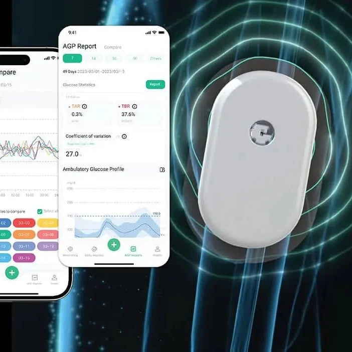 SIBIONICS GS1 – Kontinuirani merač glukoze