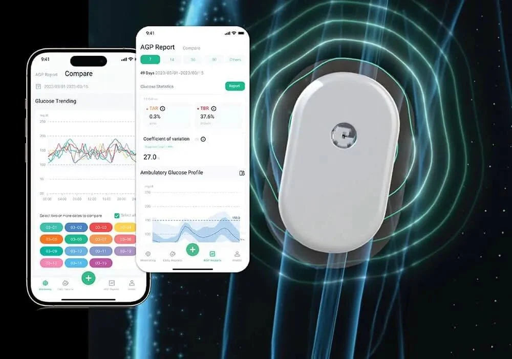 SIBIONICS GS1 – Kontinuirani merač glukoze